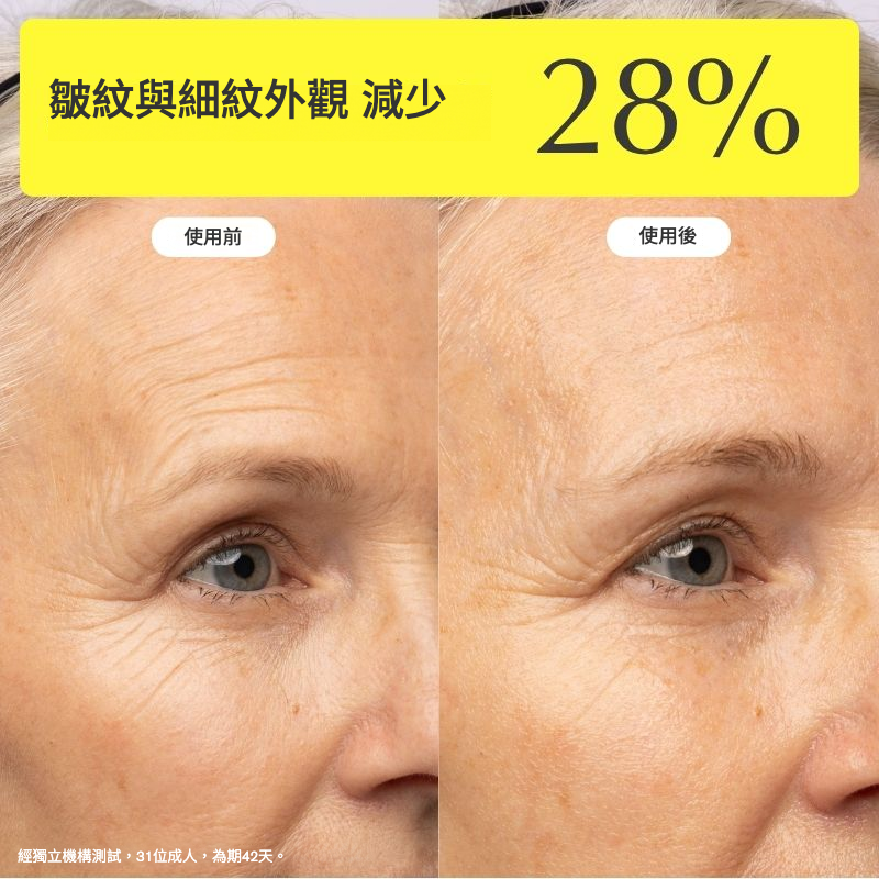 ZIIP HALO 美膚儀