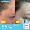 ZIIP Clear Salicylic Acid Serum