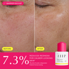 ZIIP Refresh Tranexamic Acid Serum